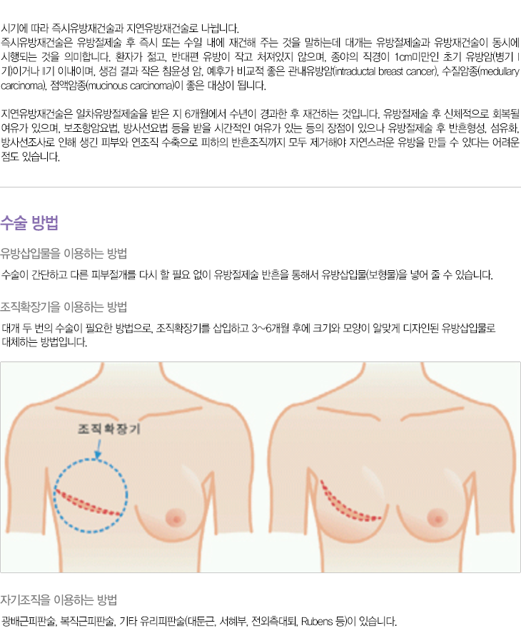 가슴재건술